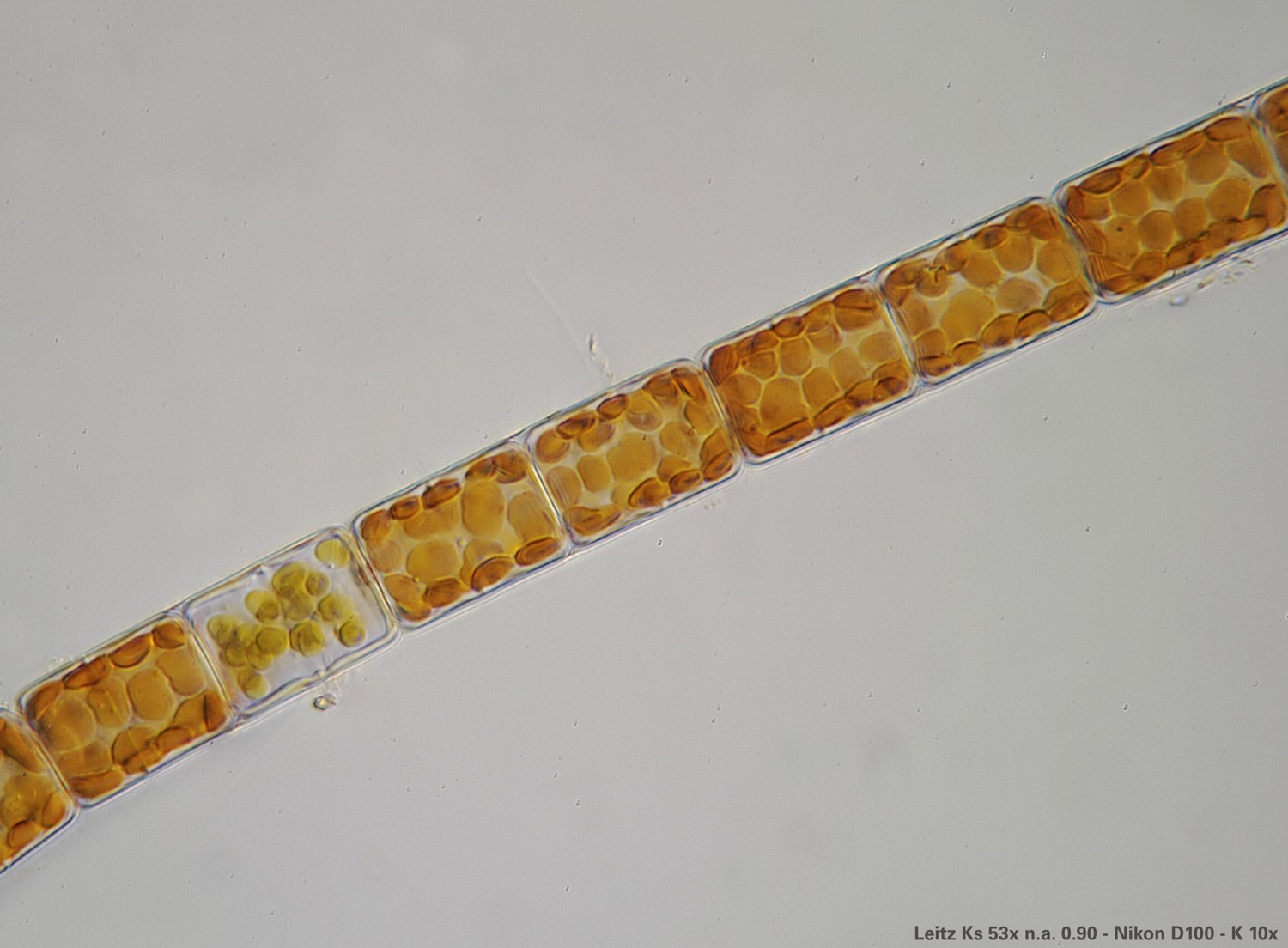 Melosira varians  (Leitz Ks 53x)